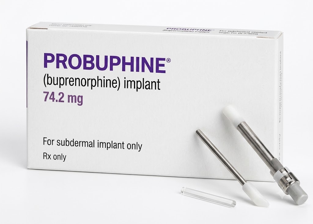 Probuphine